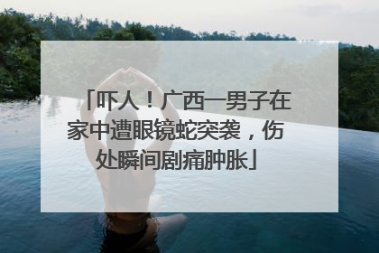 吓人！广西一男子在家中遭眼镜蛇突袭，伤处瞬间剧痛肿胀