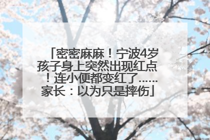 密密麻麻！宁波4岁孩子身上突然出现红点！连小便都变红了……家长：以为只是摔伤
