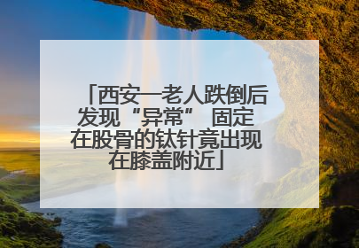 西安一老人跌倒后发现“异常” 固定在股骨的钛针竟出现在膝盖附近